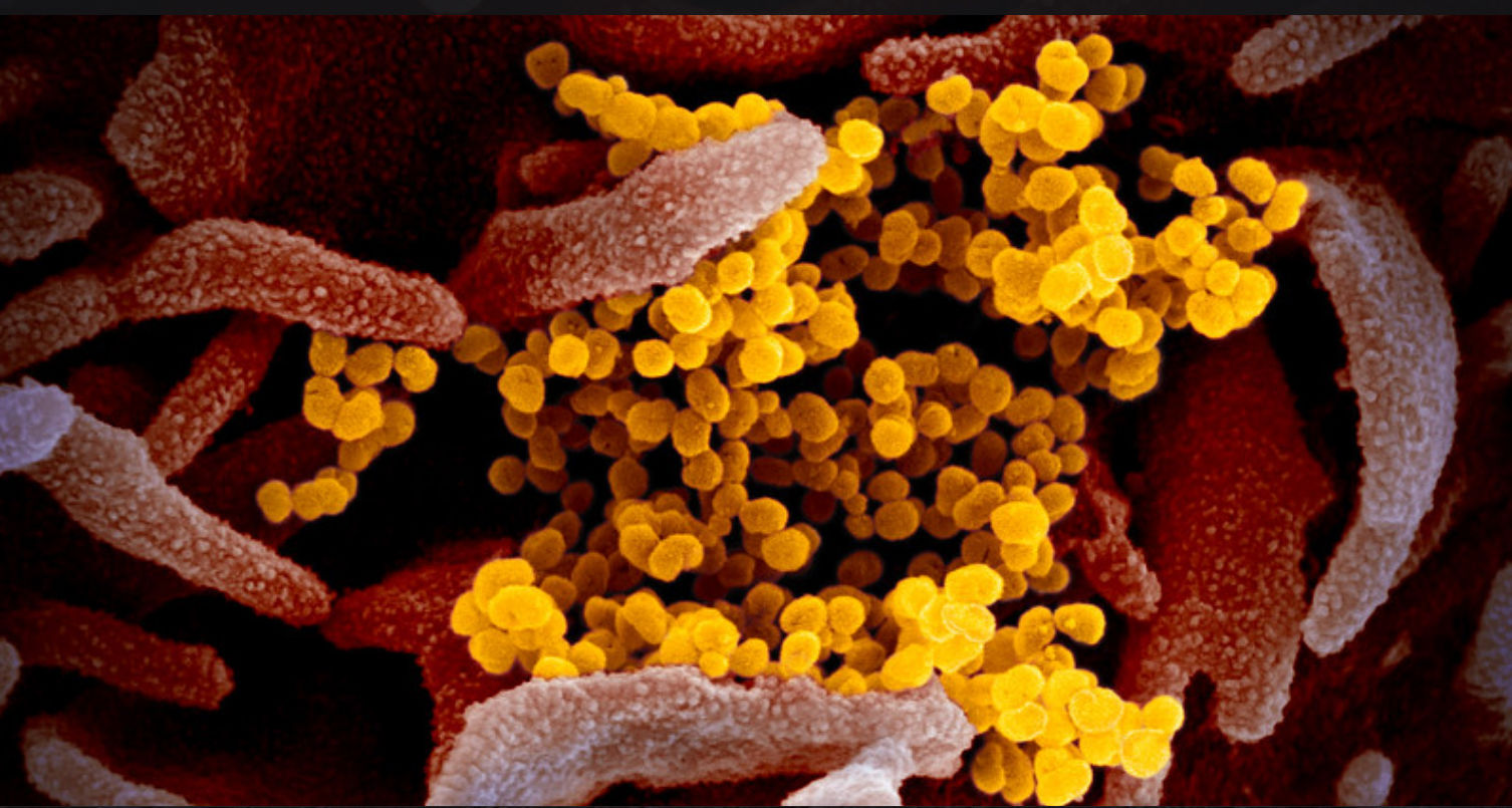 Novel Coronavirus SARS-CoV-2